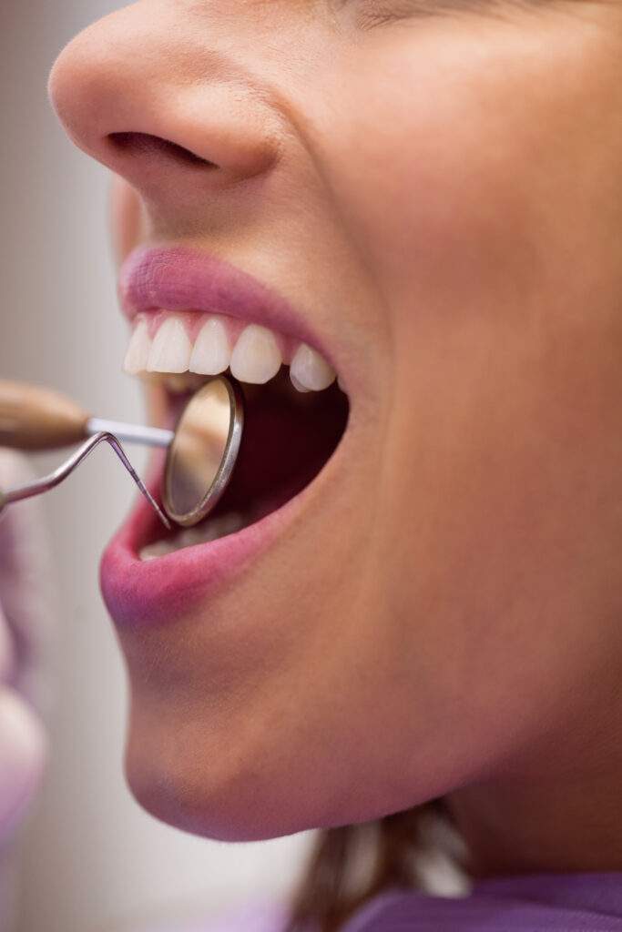Odontología general en Tetuán