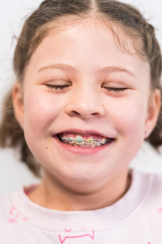 Odontología para niños en Tetuán